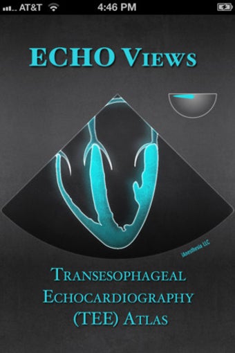 Image 0 for ECHO Views - Transesophag…