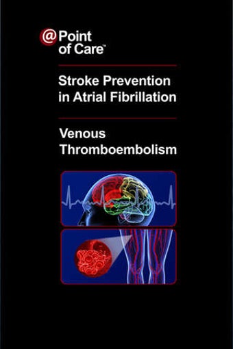 Image 0 for Stroke Prevention in Atri…