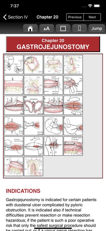 Image 3 for Zollinger Atlas of Surger…