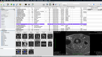 Image 0 for OsiriX