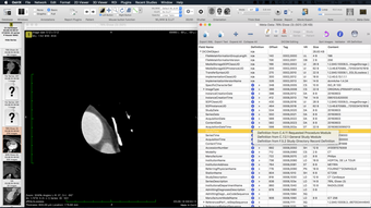 Image 1 for OsiriX