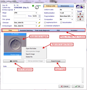 Imagen 6 para MedITEX IVF