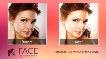 Image 0 for Blemishes Remover You Mak…