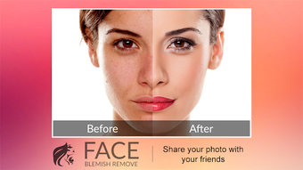 Image 1 for Blemishes Remover You Mak…