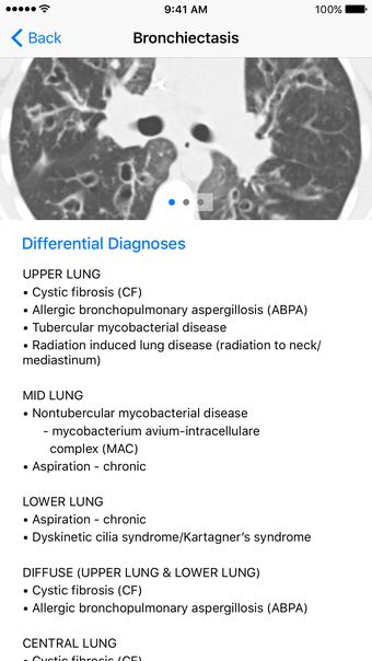 Image 0 for Thoracic Radiology Differ…