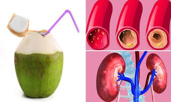Image 1 for Coconut Water Health Bene…