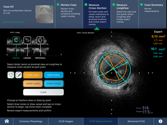 Image 3 for IVUS + Physiology Pro