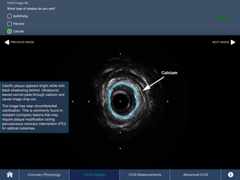 Image 2 for IVUS + Physiology Pro