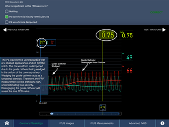 Image 0 for IVUS + Physiology Pro