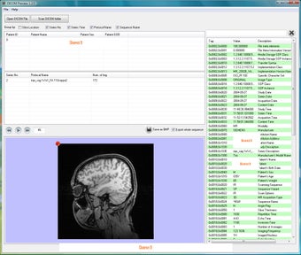 Image 0 for DICOM Preview