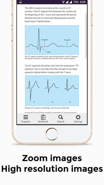Imagen 1 para ECG Basics - Full