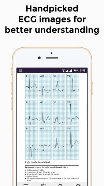 Imagen 3 para ECG Basics - Full