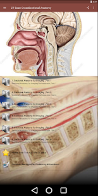 Imagen 0 para CT Scan Cross Sectional A…