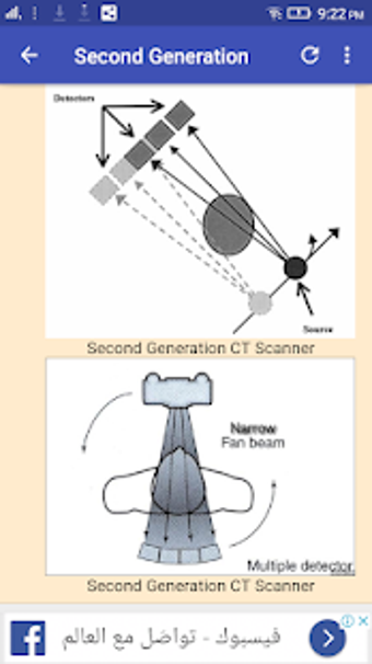 Imagen 3 para CT Scan Generations