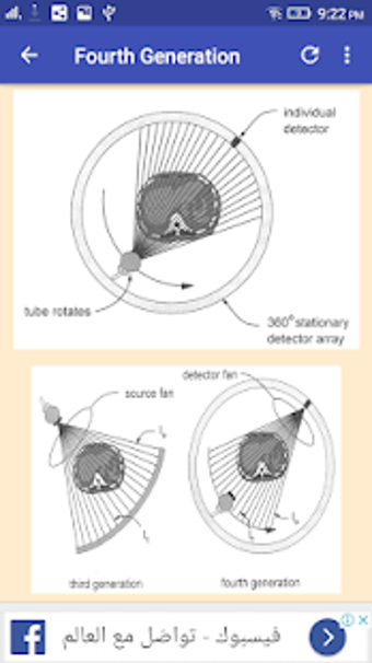 Imagen 2 para CT Scan Generations