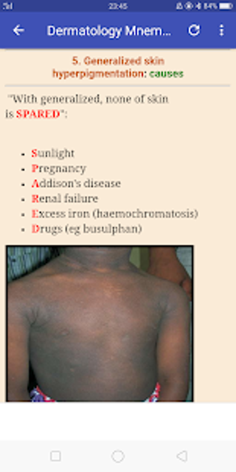 Image 0 for Internal Medicine Mnemoni…