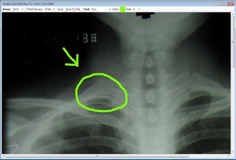 Imagen 0 para Simple EMR Metric Edition