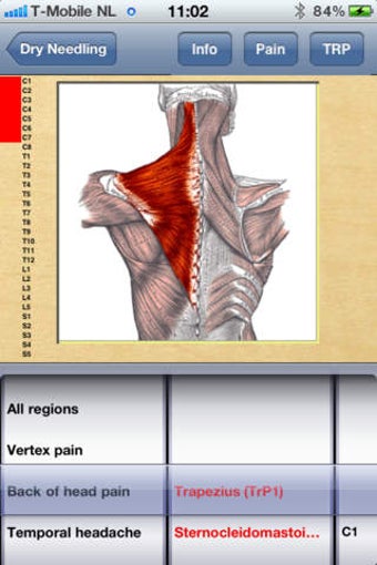 Image 0 for Dry Needling Therapy