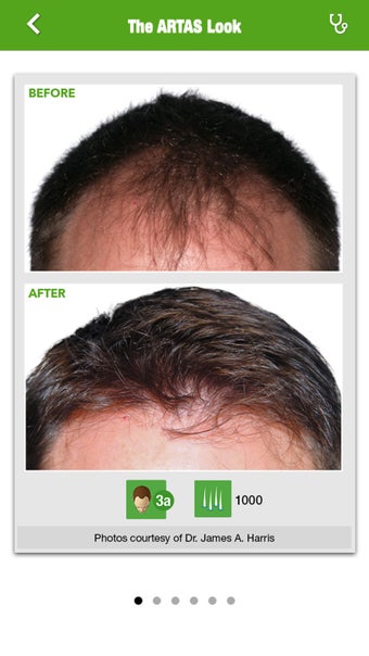 Image 2 for ARTAS Hair