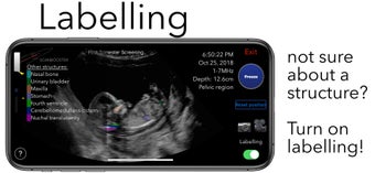 Image 0 for Scanbooster Ultrasound Si…