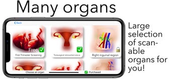Image 0 for Scanbooster Ultrasound Si…