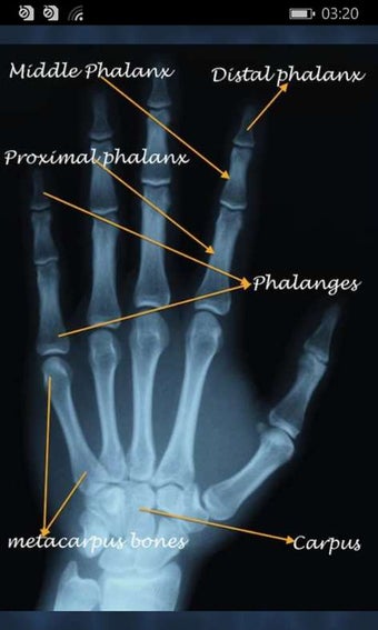Image 3 for Xray Camera Scanner for W…