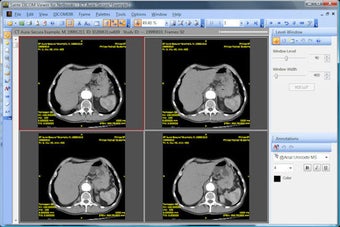 Imagen 0 para Sante DICOM Viewer for Ne…