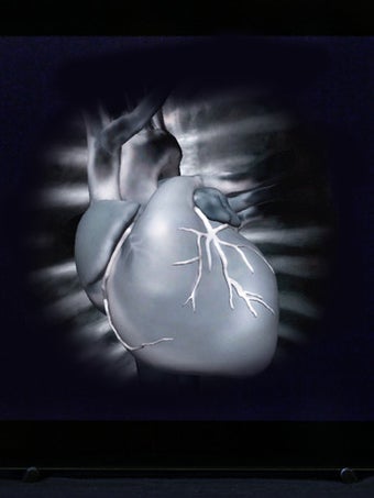 Image 1 for HeartCam
