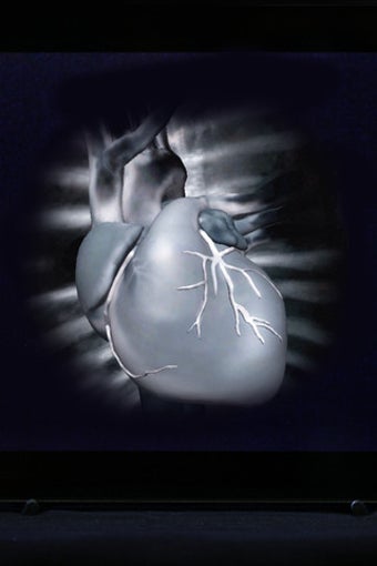 Image 7 for HeartCam