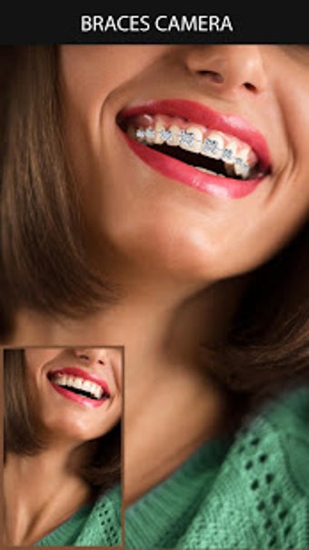 Imagen 2 para Braces Camera