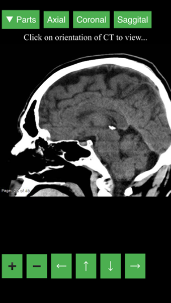 Image 3 for Radiology CT Viewer