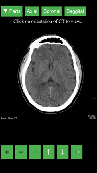 Image 2 for Radiology CT Viewer