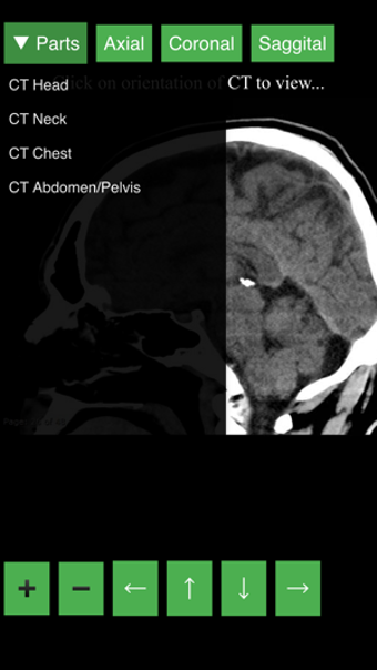 Image 1 for Radiology CT Viewer