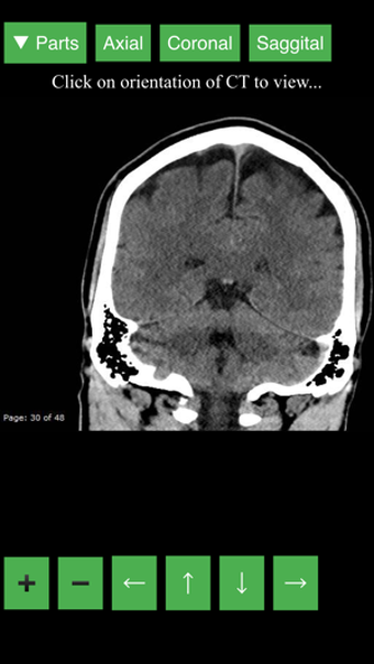 Image 0 for Radiology CT Viewer