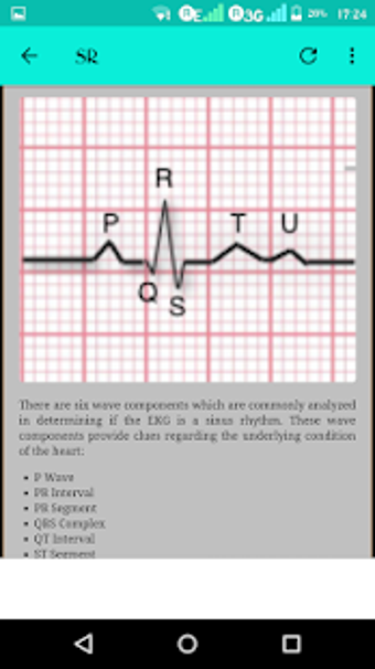 Image 1 for Heart Murmurs