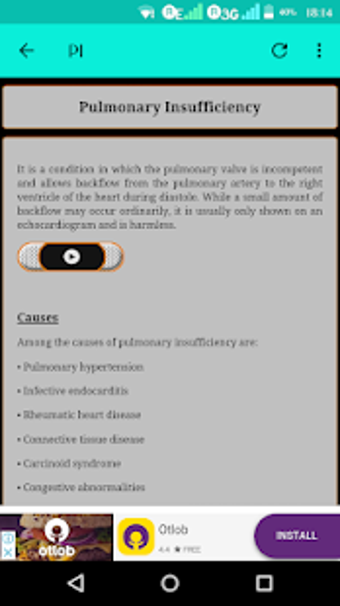 Image 2 for Heart Murmurs