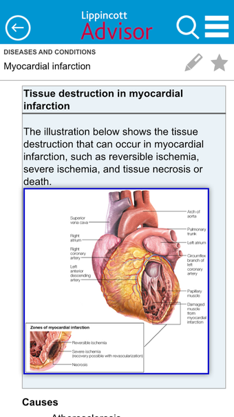 Image 0 for Lippincott Nursing Adviso…