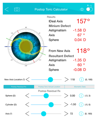 Image 2 for Panacea IOL & Toric Calcu…