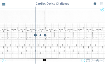 Image 2 for Cardiac Device Challenge