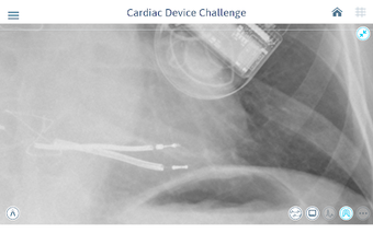 Image 1 for Cardiac Device Challenge