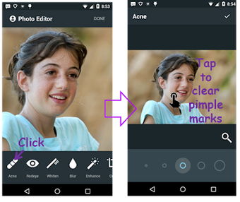 Image 2 for Face Pimple Blemish Remov…