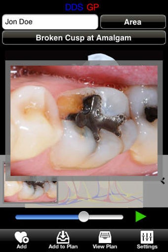 Image 0 for DDS GP