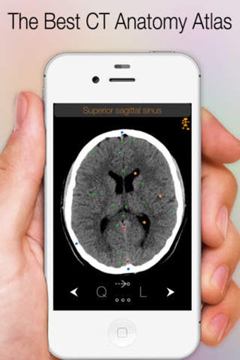 Imagen 0 para CT Anatomy