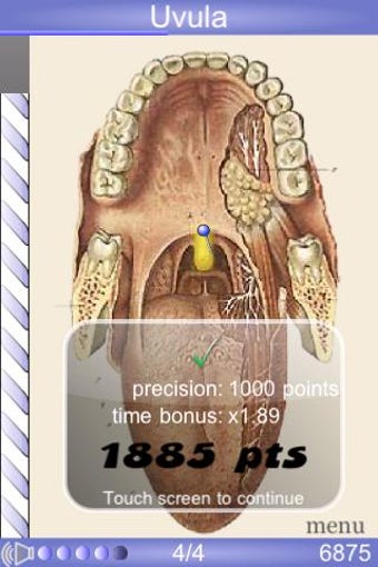 Imagen 1 para Speed Anatomy
