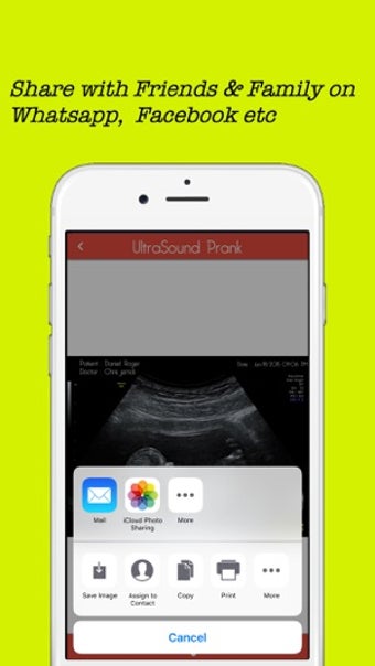 Image 2 for Baby Ultrasound spoof