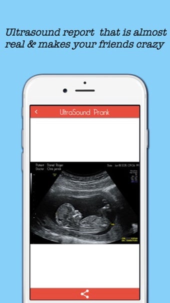 Image 0 for Baby Ultrasound spoof