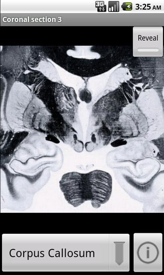 Imagen 0 para NeuroSlice