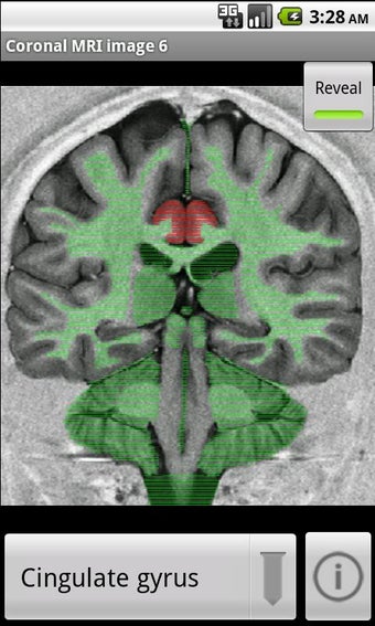 Imagen 1 para NeuroSlice