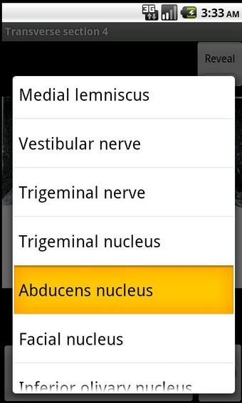 Imagen 2 para NeuroSlice