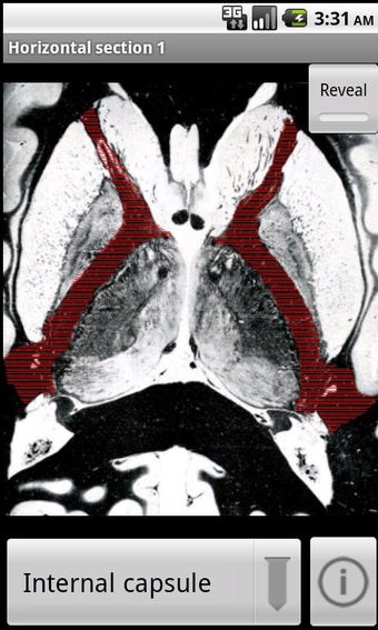 Imagen 3 para NeuroSlice